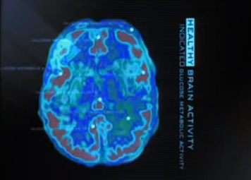 Brain Image - PET scan of health brain