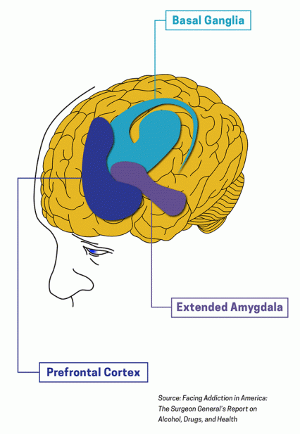 This is an image of a person with the brain highlighted. The basal ganglia, extended amygdala, and prefrontal cortex are called out. 