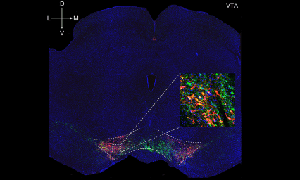 Brain slice containing ventral tegmental area where dopamine neurons are expressing excitatory virus