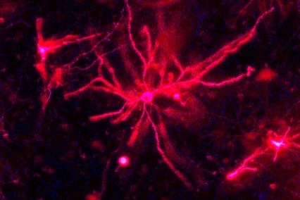 A mouse neuron in the striatum. Colorized from original.