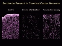 Scans showing the presence of serotonin in Cerebral Cortex neurons