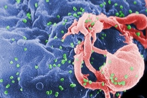 Image of HIV
