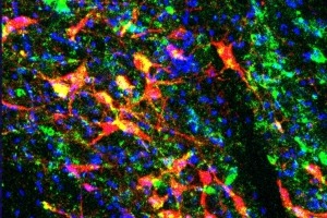 Imagen transversal de un cerebro que ilustra el área tegmental ventral donde las neuronas dopaminérgicas expresan el virus excitatorio